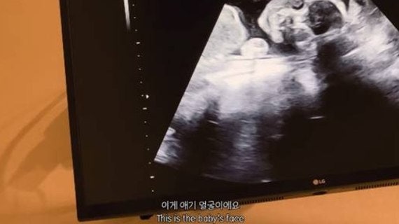 박주호 아내 넷째 임신 발표, 댓글창이 난리난 이유가 있었다