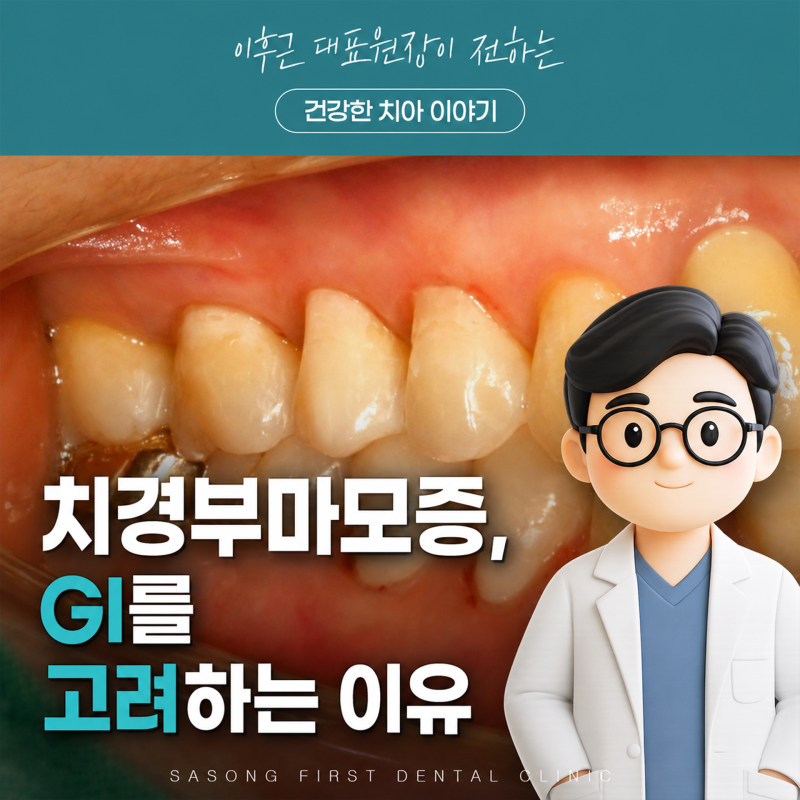 잇몸이 패이고 이가 시릴 때 Gi 치료를 많이 적용하는 이유