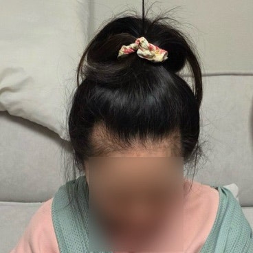 산후탈모엔 채정안이 추천한 리바이탈래쉬 볼륨 인핸싱 폼 / 잔디머리 후기