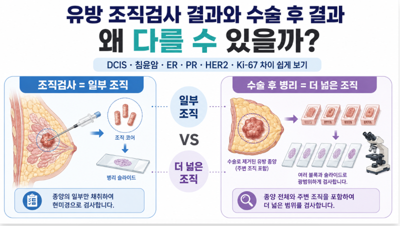 유방 조직검사 결과와 수술 후 병리결과가 다른 이유｜왜 진단이 바뀔까?