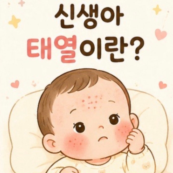 신생아 태열 관리 (아이홉 수딩젤 아토엠디크림 비판텐)