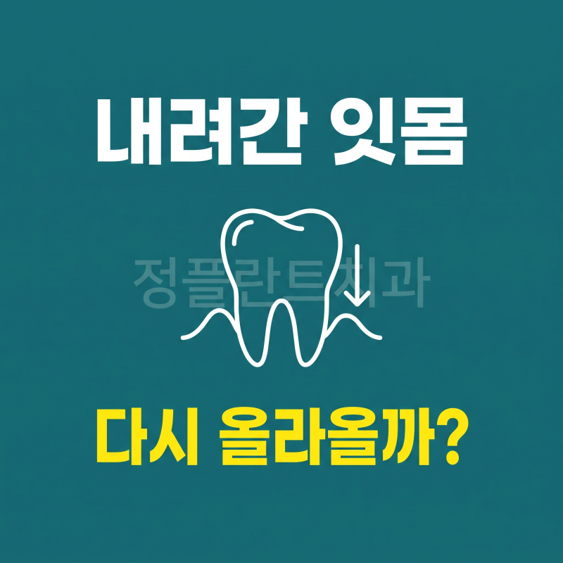 신창치과 잇몸내려앉음 ｜ 한번 내려간 잇몸, 다시 올라올까요?