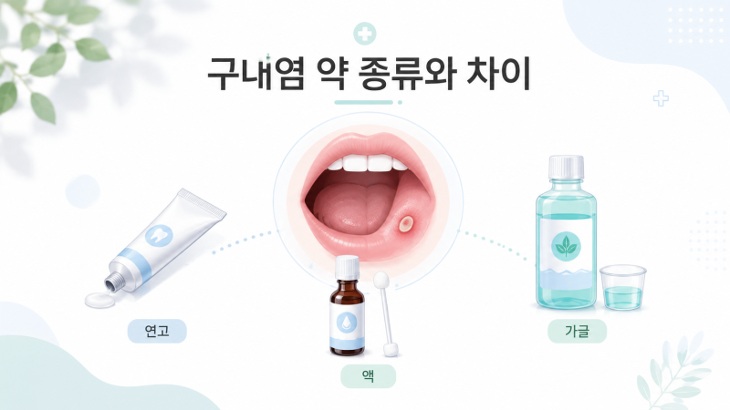 구내염 약 (2) 유명 제품 종류와 차이| 오라메디·알보칠·아프니벤큐·오라페인큐겔 언제 쓸....