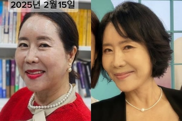 "3000모에 500만원 안 됐다" 윤영미 모발이식 후기, 안면거상보다 힘들었던 이유