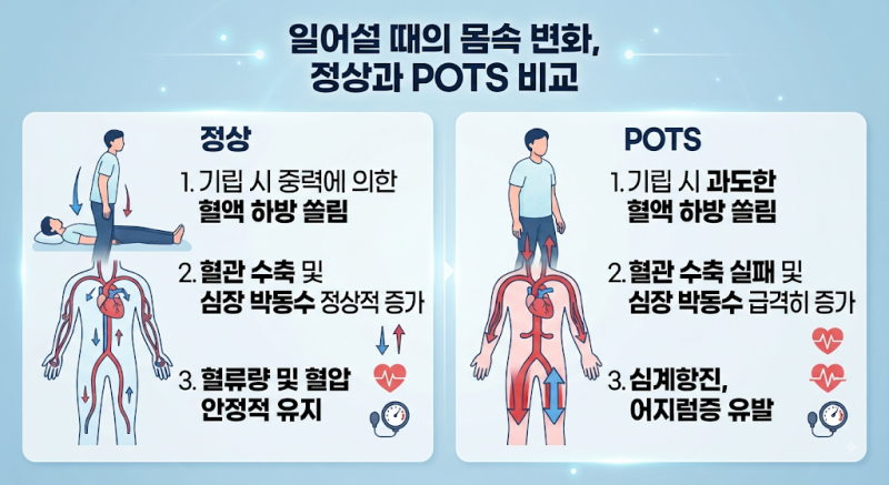 체위성기립빈맥증후군(POTS)이란