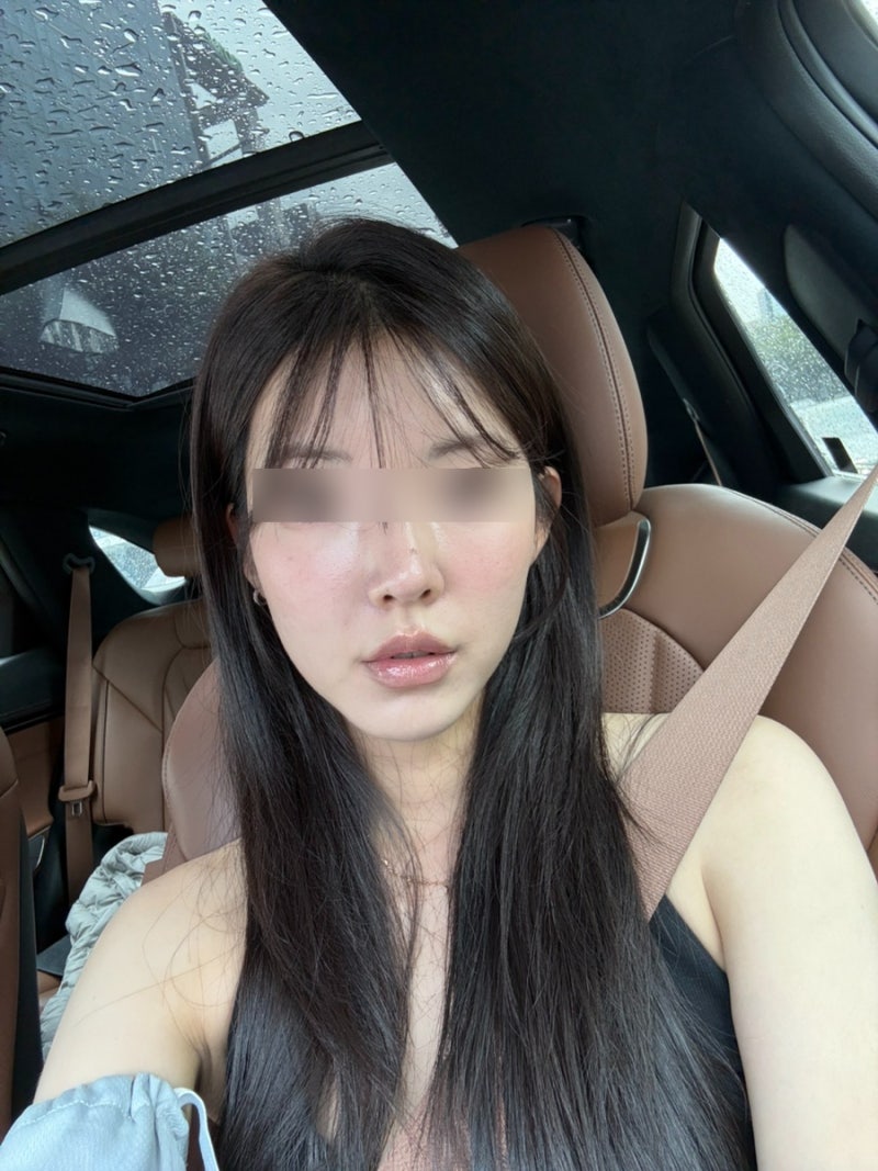 청담피부과 무통 고우리 스킨부스터 효과 고우리 스킨부스터 후기 가격