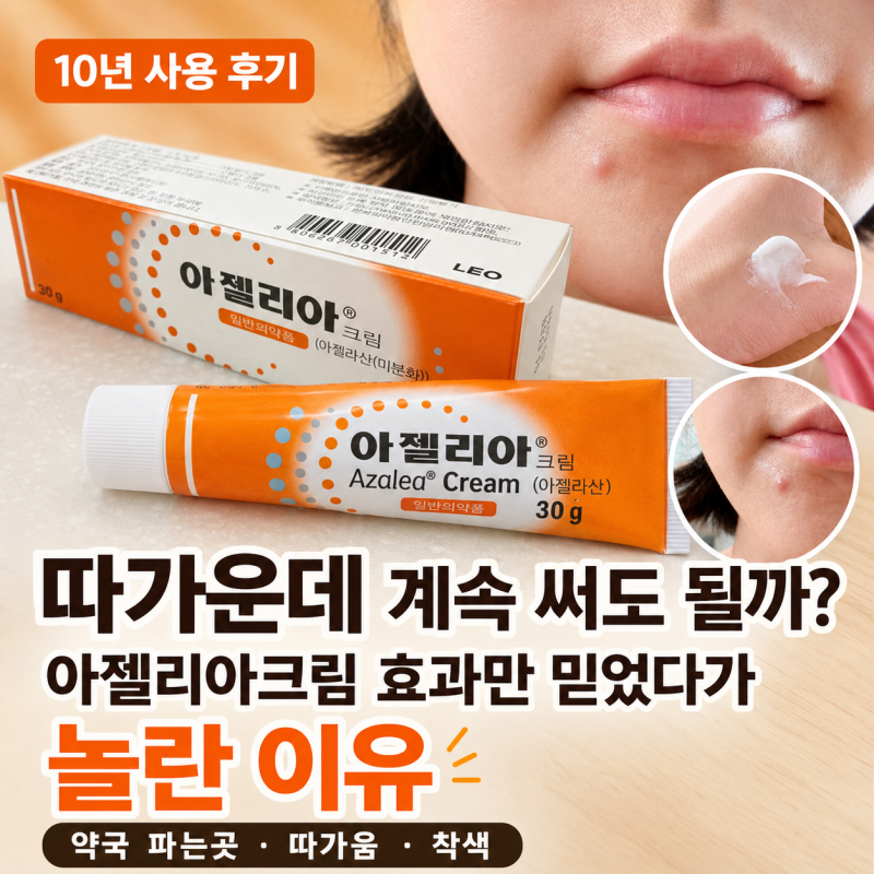 아젤리아크림 약국 파는곳 효과 어때? 아젤리아연고 따가움 착색 10년 후기
