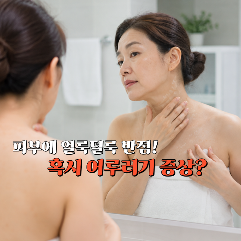 어루러기 전염될까? 피부 어루러기 원인과 치료법