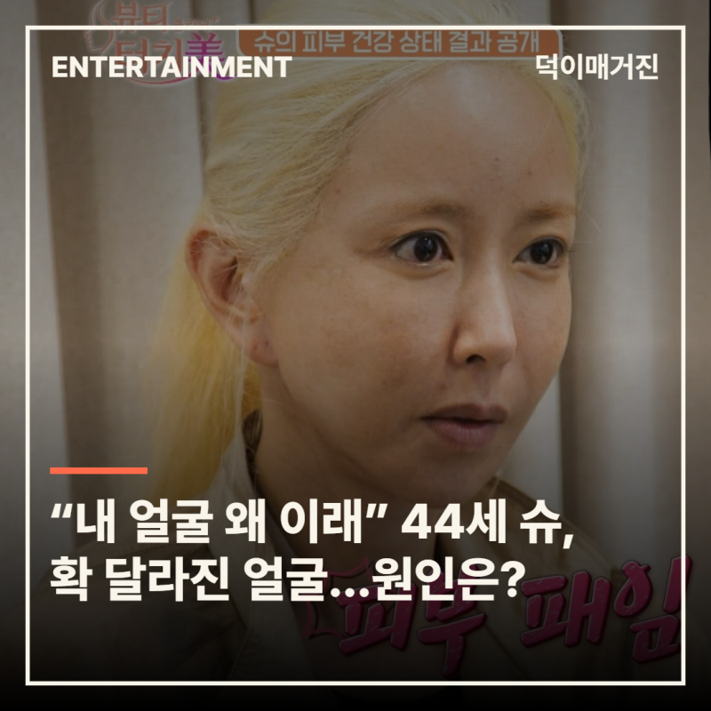 “내 얼굴 왜 이래” 44세 슈, 확 달라진 얼굴…원인은 의외의 생활습관