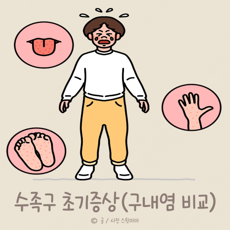3세 아이 수족구 초기 증상,진행과정 (ft.입안 물집 구내염 완치 후기)