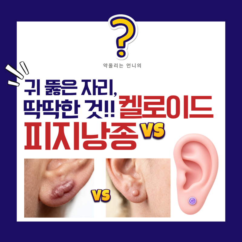 귀 뚫은 자리 딱딱한 것, 피지낭종 아니라 켈로이드일 수 있어요!