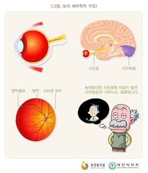 '소리 없는 시력 도둑' 녹내장의 모든 것: 원인부터 예방법까지 10가지 정리