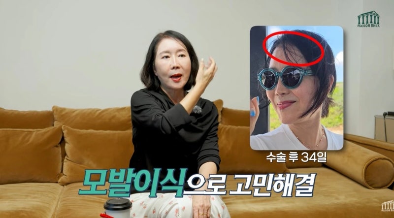 윤영미, 10kg 감량에 안면·목 거상까지…모발이식 공개한 이유는?