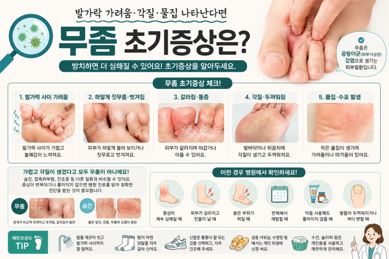 1. 무좀 초기증상은?｜발가락 가려움·각질·물집 나타난다면