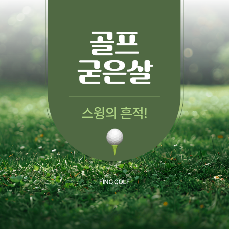 손바닥에 남겨진 스윙의 흔적! 골프 굳은살