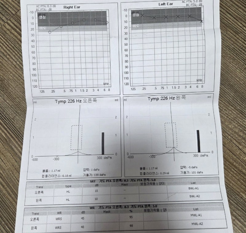 돌발성난청(급성저음성난청)으로 시작했다가 메니에르 의증이 된 투병일기