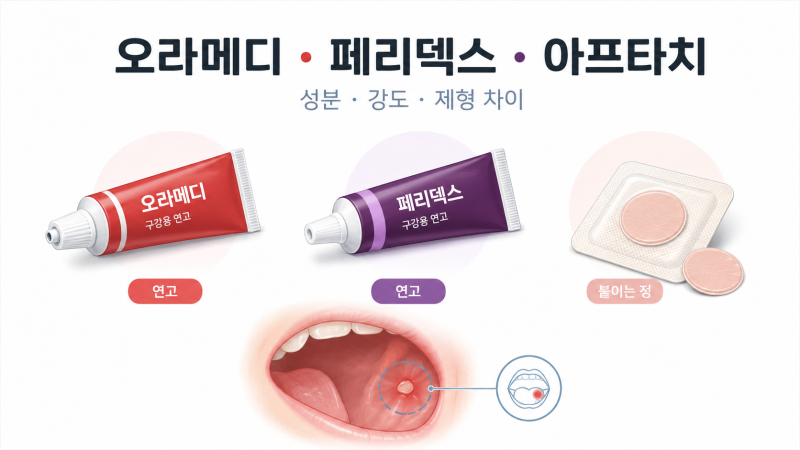 구내염 약 (3) 오라메디 페리덱스 아프타치 차이 | 스테로이드 세기와 바르는 약·붙이는 약 ....