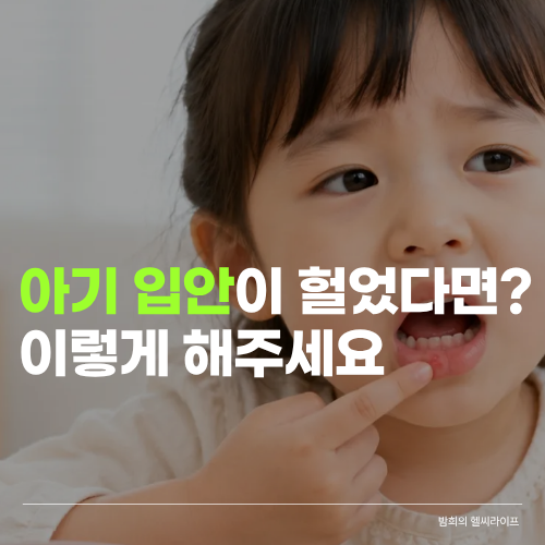 아기 구내염 빨리 낫는 법, 밥 안 먹을 때 엄마가 해줄 수 있는 것