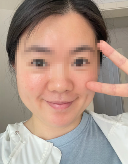 트라넥삼산 효능 찾다가 결국 홈케어 디바이스로