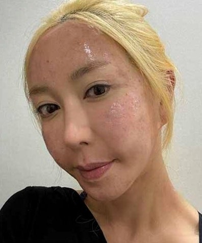 슈, 팔자주름 극복 얼굴 변신으로 되찾은 요정 비주얼