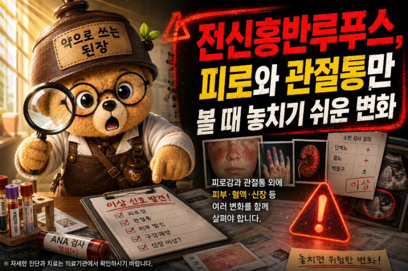 전신홍반루푸스, 피로와 관절통만 볼 때 놓치기 쉬운 변화