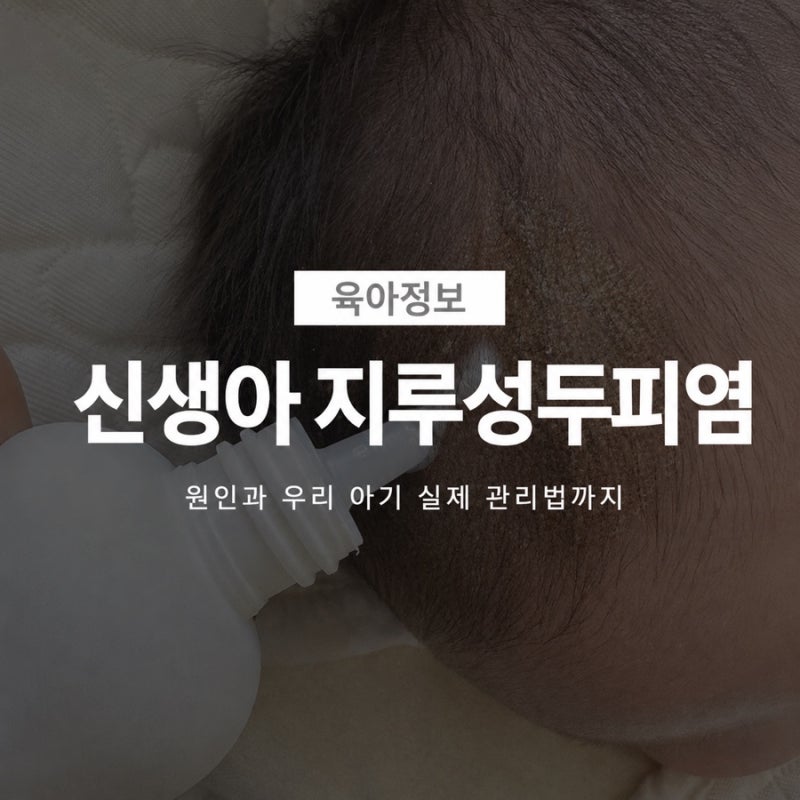 신생아 머리에 하얀 각질이 생겼다, 한 달 관리해본 방법,아기 지루성 두피염 원인과 관리