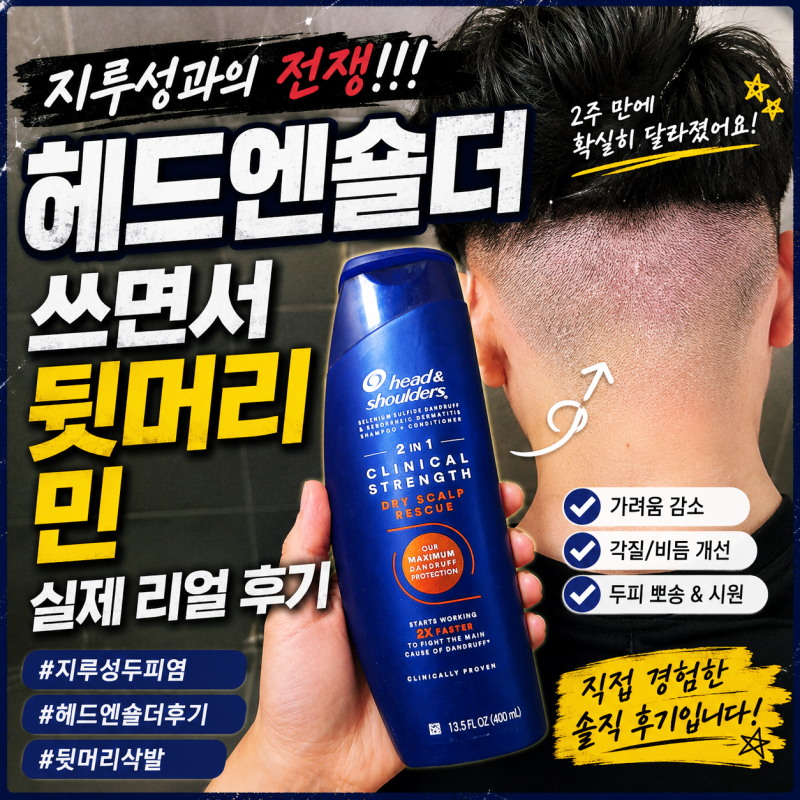 헤드앤숄더 클리니컬 오렌지 사용 후기｜지루성두피염 때문에 뒷머리 민 후기 (광고X)