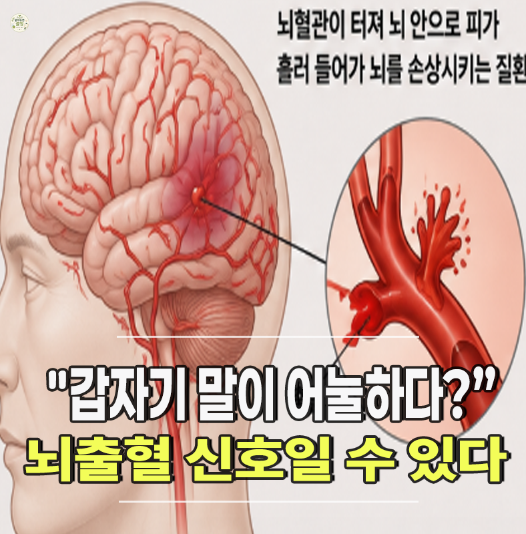 뇌출혈 전조증상｜갑자기 두통·말 어눌하면 절대 그냥 자면 안 되는 이유