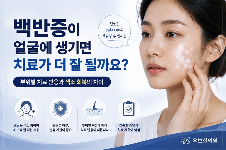 백반증이 얼굴에 생기면 치료가 더 잘 될까요?