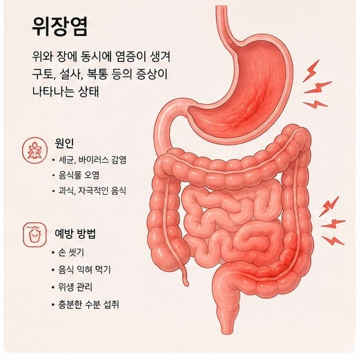 갑자기 찾아온 급성 위장염 증상｜명치 통증부터 구토, 아랫배 통증까지