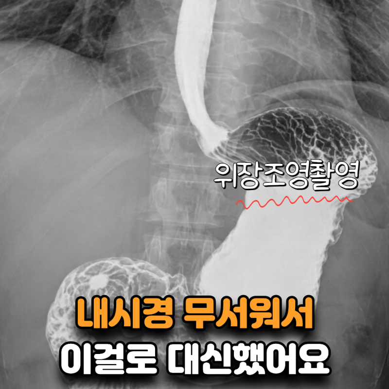 “위내시경 무서워서 이걸로 대신했어요” 위장조영촬영 어디까지 보일까?