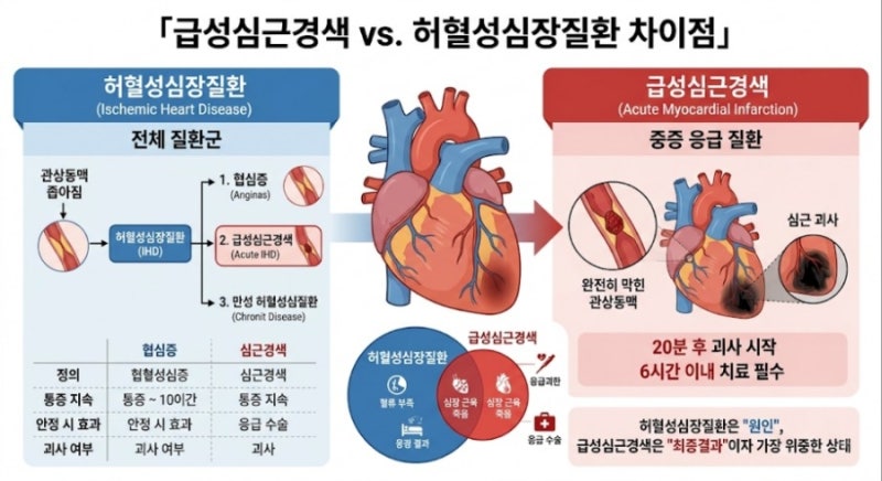 「급성심근경색과 허혈성심장질환은 어떻게 다른가요?」