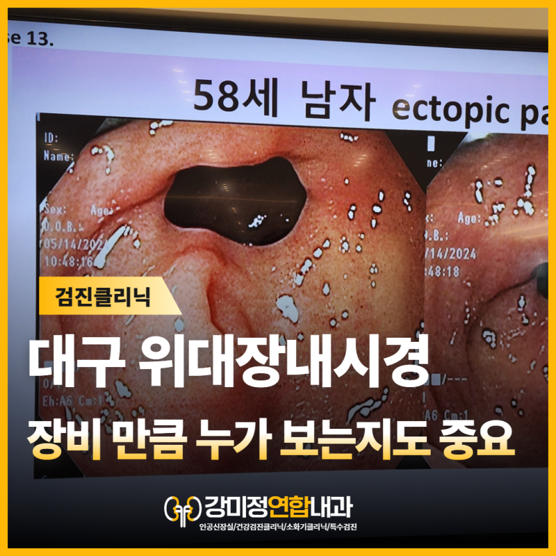 대구 위대장내시경, 검사 장비만큼 ‘누가 보는지’도 중요합니다