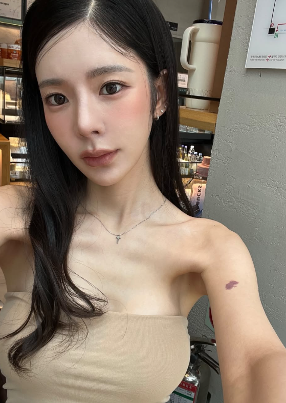 “슈스케 장재인이라고?”...몰라보게 뼈말라 된 근황·나무위키 프로필