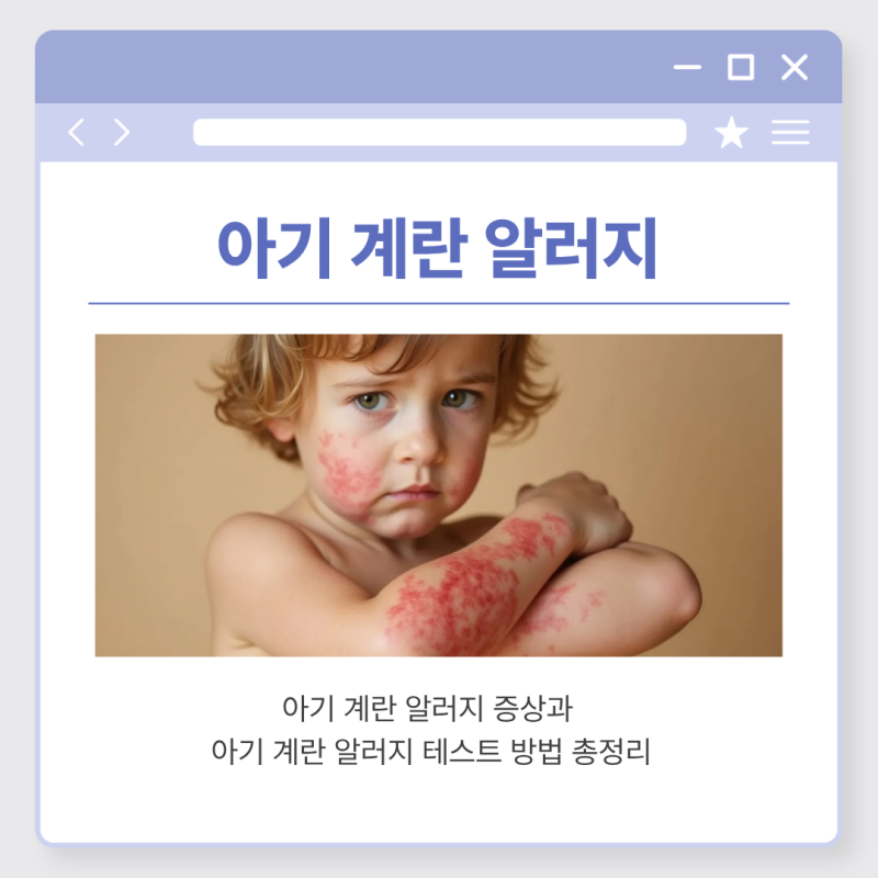 아기 계란 알러지 증상과 테스트 방법 | 이유식 이것도 모르고 시작하면 위험해요!