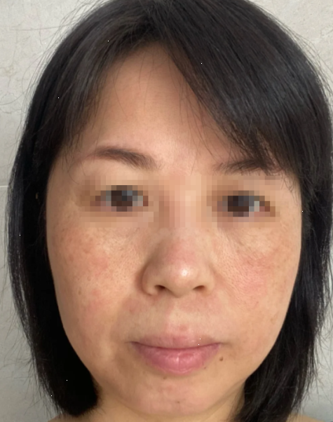 메디힐 마스크팩 티트리 한 달 써보고 남긴 솔직후기