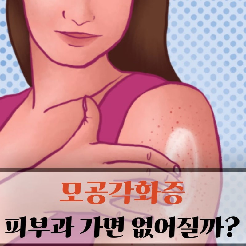 “나도 이제 민소매 입을 수 있을까?” 피부과 의사가 알려주는 모공각화증 치료 가능 VS 불....