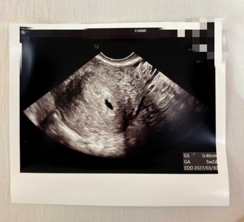[임신 4주차 일기] 배란15일차~배란19일차 임테기 및 증상, 배란18일차 임테기 역전, 배란 19일....