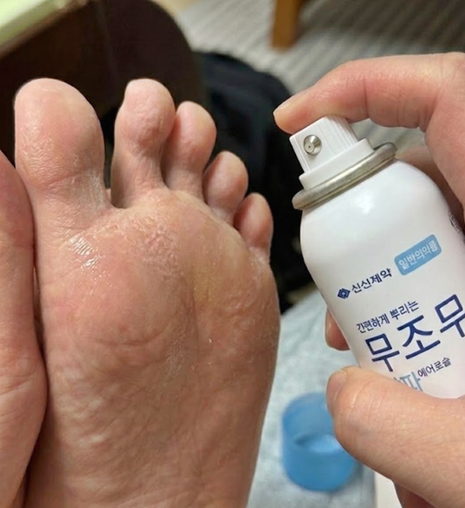 약국 신신제약 무조무 꼭 알아야 할 뿌리는 무좀약 사용법