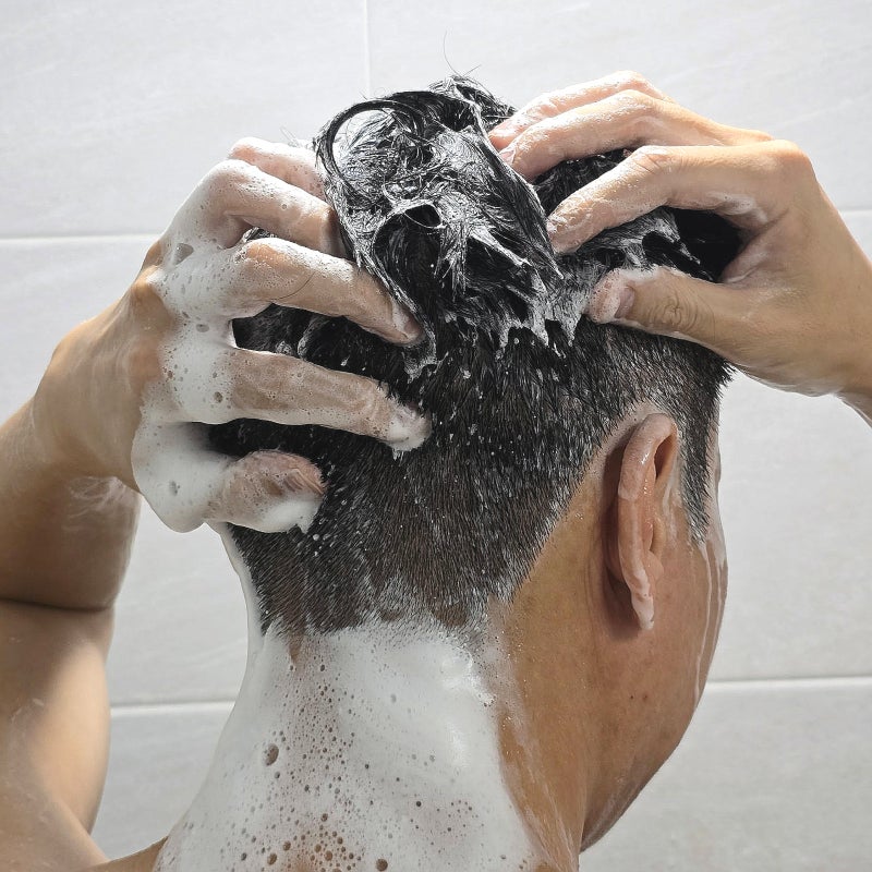 "진작 쓸걸 후회했다" 가려움증 단번에 잠재운 비듬 샴푸 추천
