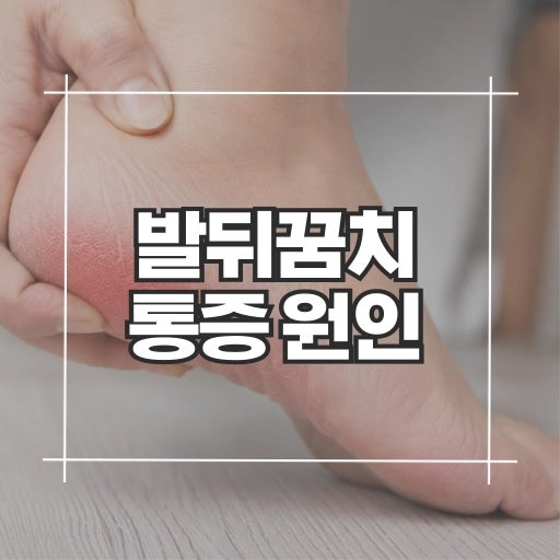 발뒤꿈치통증 원인 8가지, 걸을 때 아픈 이유와 병원 가야 할 때