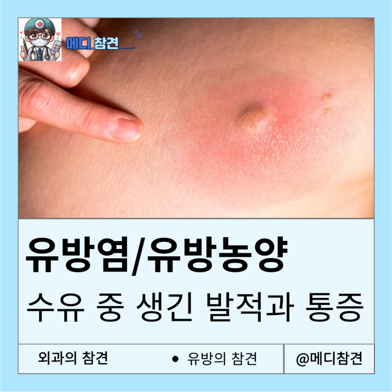 mastitis 유방염 breast abscess 유방농양 의학용어 증상 치료