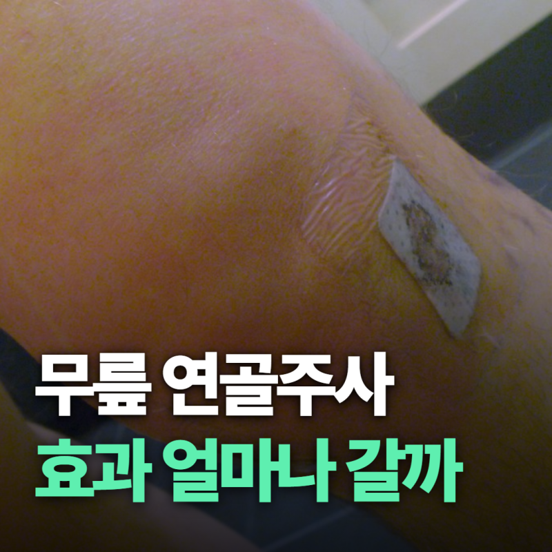 무릎 연골주사, 1~2만원인데 효과는 얼마나 갈까 맞기 전에 알 것들
