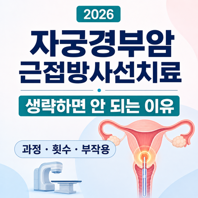 2026 자궁경부암 근접방사선치료 총정리｜생략하면 안 되는 이유·과정·부작용