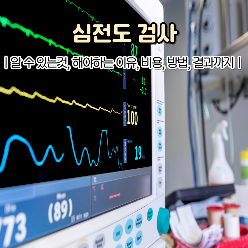 심전도 검사 해야 하는 이유 비용 목적 검사 방법 시간 결과 보는법