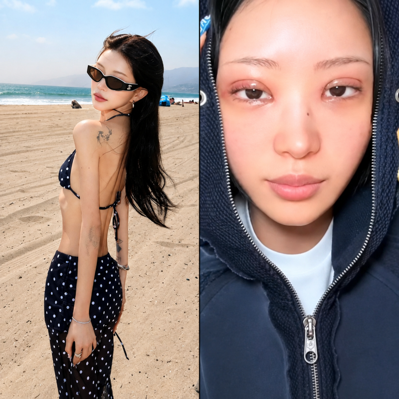 故 최진실 딸 최준희 뼈 말라에 이어 또 성형, 이 정도면 성형중독?