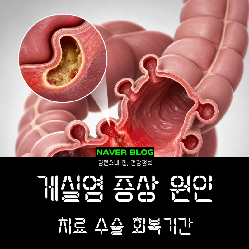 게실염 증상 원인 및 치료, 수술 시 회복 기간은?