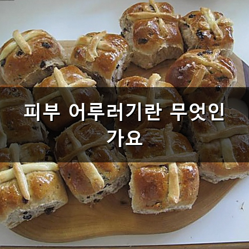 피부 어루러기 증상 원인과 올바른 관리 방법