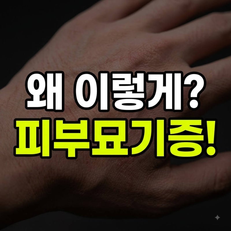 피부묘기증 증상부터 관리법까지: 긁은 자국이 그대로 올라온다?