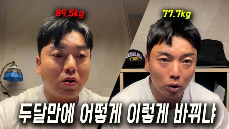 곽범 시술 중독 수천만 원 투자한 이유